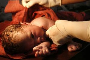 الولادة القيصرية في سوريا.. من الضرورة الى الاختيار والإجهاض «ممنوع»!