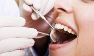 أطباء الأسنان يناشدون بضرورة رفع أجور المعاينة
