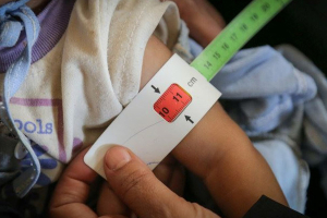 تقرير: ارتفاع حالات « سوء التغذية» في سورية 20 بالمئة عن العام الفائت!!