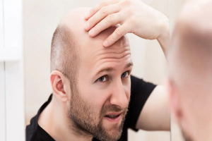 العلماء يقتربون من إيجاد علاج «للصلع».. باحثون ينتجون لأول مرة بصيلات شعر مطبوعة «بتقنية ثلاثية الأبعاد» في أنسجة الجلد البشرية