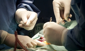 ارتفاع أجرة العمليات الجراحية بنسبة 500% بسبب الارتفاع الفاجش بأسعار المواد الخاصة بها