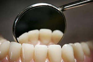 كيف تحمي أسنانك من التسوس؟.. إليك 8 نصائح ذهبية